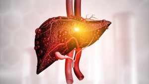 higado-graso