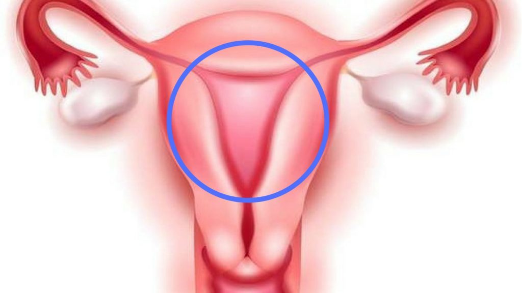 Utero_-Como-se-compone-y-sus-tipos-1-1