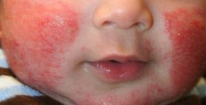 Webp.net-resizeimage-2019-09-12T171827.886-1170x600