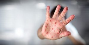 bigstock-165116978_opt-1170x600