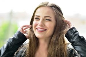 Bigstock-brackets-ortodoncia-768x513