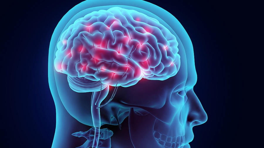cerebro