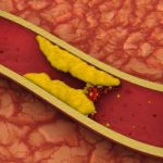 Colesterol: la dieta y el ejercicio tienen efectos distintos