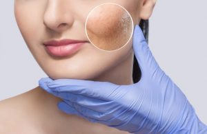 bigstock-A-Young-Girl-With-A-Problem-Sk-344096734-e1604058591815-768x499