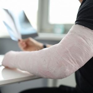 bigstock-close-up-of-man-with-broken-ar-453635251_1_621x621