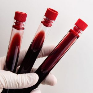 bigstock-close-up-hands-of-a-doctor-hol-458200935_1_621x621