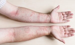 AdobeStock_465489473.2e16d0ba.fill-691x415