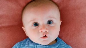 1010x567_labio-leporino-453332-192448