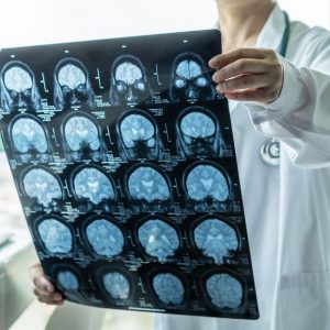 bigstock-brain-disease-diagnosis-with-m-328571134_1_621x621