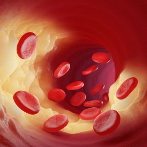 bigstock-red-blood-cells-leak-into-the-461099909_1_621x621