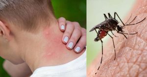 ¡IMPORTANTE-Así-evitarás-las-enfermedades-transmitidas-por-mosquito