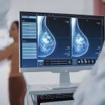 Hoy los tratamientos se adaptan a cada tumor