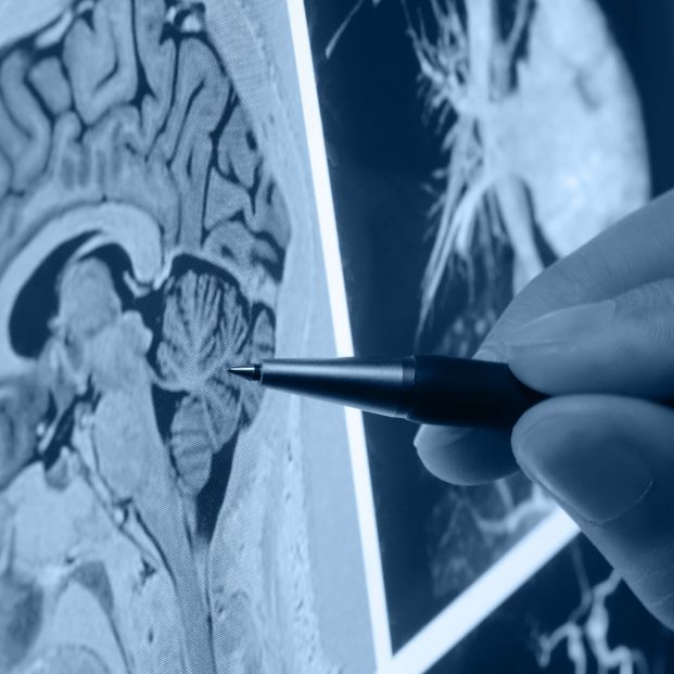 funcionamiento-de-la-dopamina_1_621x621