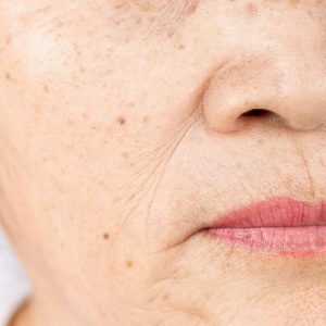 puntos-rubi_1_621x621