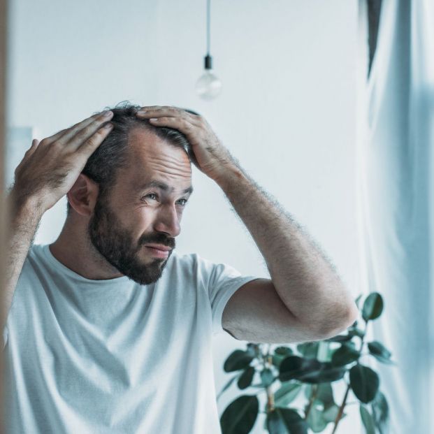 distintas-formas-de-disimular-la-calvicie-ademas-de-las-clasicas-pelucas_1_621x621