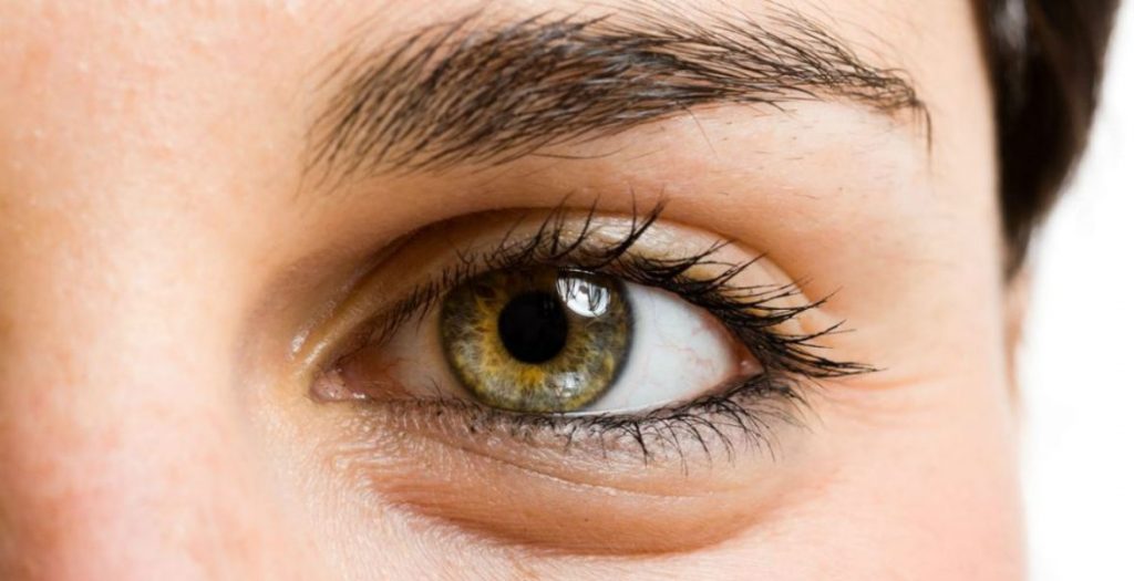 bolsas-debajo-de-los-ojos-1200-1170x600