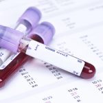 ¿Con qué frecuencia hay que hacerse análisis de sangre?