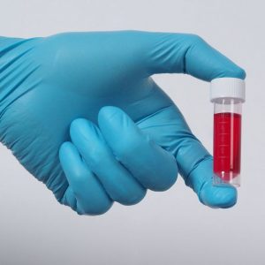 bigstock-blood-tube-covid-test-doc-410312485_1_621x621