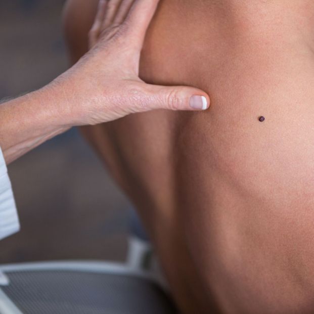 los-avances-en-el-diagnostico-del-melanoma-se-dirigen-hacia-el-uso-de-inteligencia-artificial_1_621x621