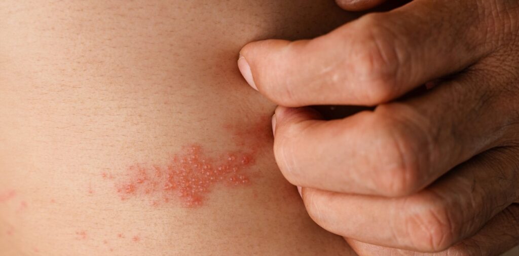 EpCtttgMZ_1256x620__1