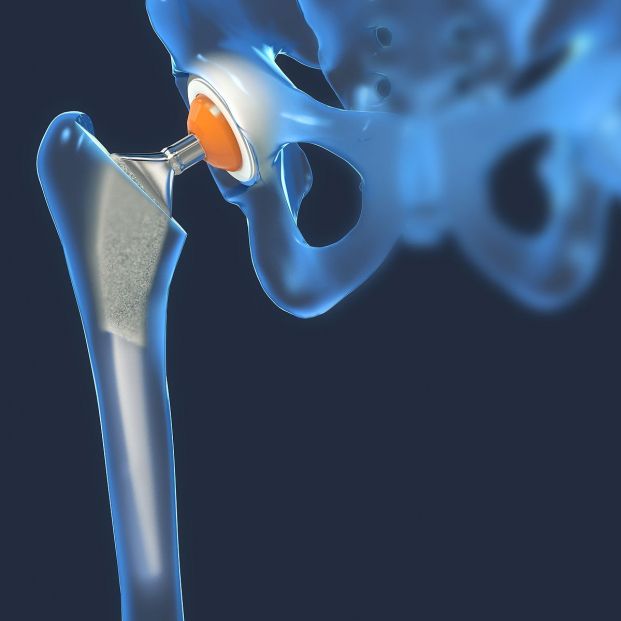 bigstock-function-of-a-hip-joint-implan-456724401_1_621x621