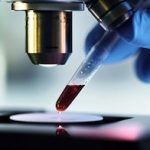 Por qué el virus de VIH persiste en algunos pacientes