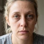 La cantidad de sueño no influye en las ojeras