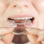 Las causas menos conocidas del rechinado de los dientes