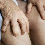 El desgaste articular