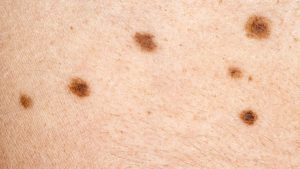 skin-1200x675-1