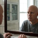 Probaron una droga para la artritis y la caída del pelo