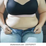 Buena opsión para mujeres con obesidad