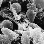Cómo se contagia la bacteria de la peste neumónica